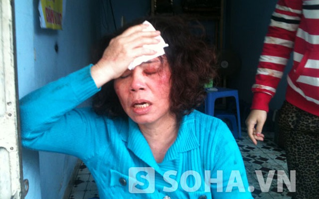 Người đàn bà bị chồng và con trai đánh gãy cổ lại bị hành hung