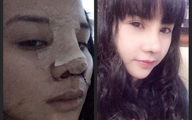 Màn "lột xác" kinh ngạc của thiếu nữ Hà Thành sau khi PTTM
