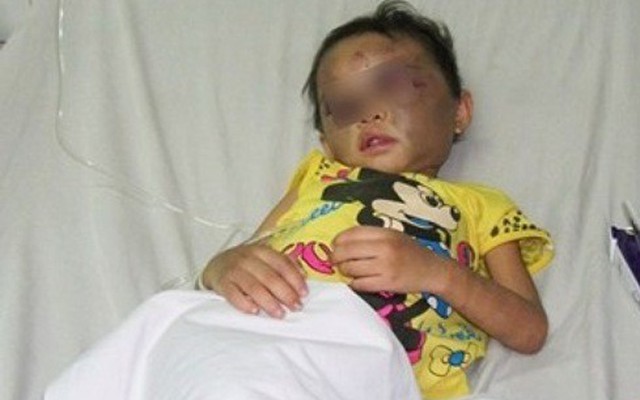 Bé gái 4 tuổi bị đánh dã man: "Sao con khổ thế này hả Ngân"