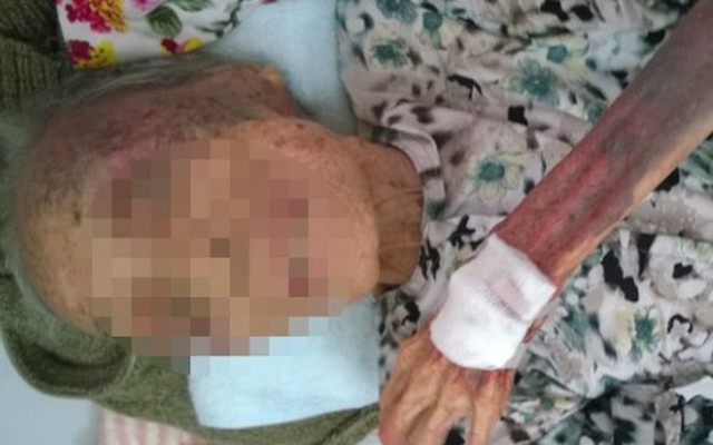 Triệu tập người con bất hiếu đánh đập mẹ già 94 tuổi tàn nhẫn