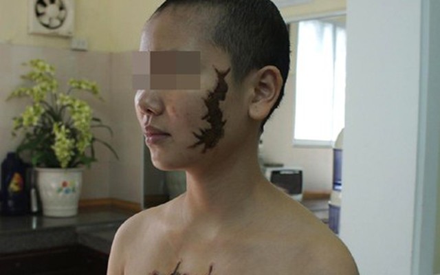 Vụ cô gái bị xăm con rết lên mặt và ngực: Phục hồi điều tra