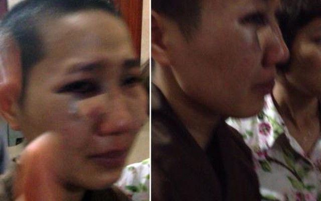 Một nữ tu bị 3 người phụ nữ đánh bất tỉnh trong chùa