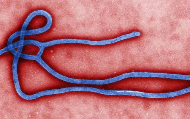 Báo động dịch virus Ebola đã cận kề Việt Nam