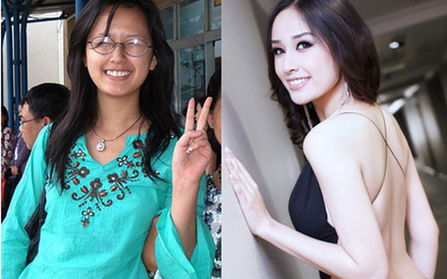 8 sao Việt nhổ răng, nẹp răng để thay đổi diện mạo
