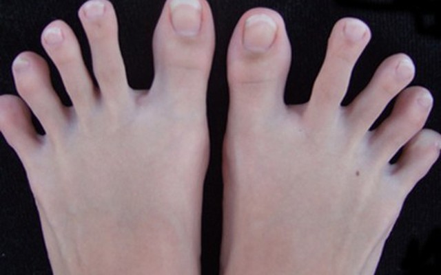 Đố bạn làm được: phân biệt 3 ngón chân bất trị ai cũng có