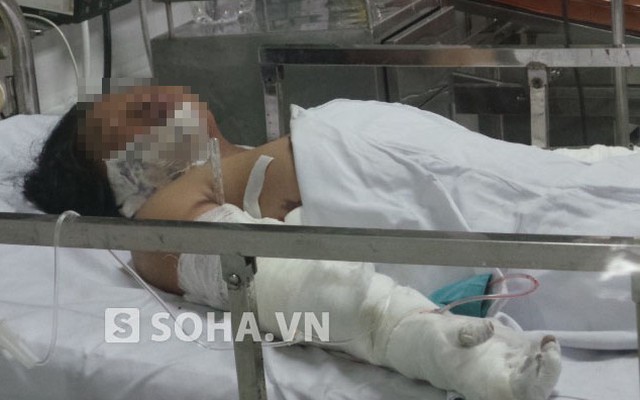 Bé gái bị mẹ ruột tưới xăng đốt ở Bình Thuận bỏng nặng ở lưng