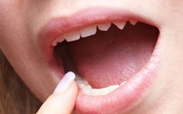 Màu sắc của lưỡi tiết lộ gì về sức khỏe?