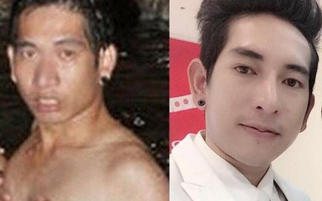 Chàng trai Thái Lan công khai quá trình PTTM sau khi bị bạn gái bỏ rơi