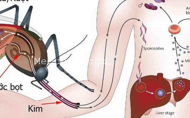 Đừng ăn trứng, uống nước ngọt khi đang mắc bệnh này kẻo nguy hiểm