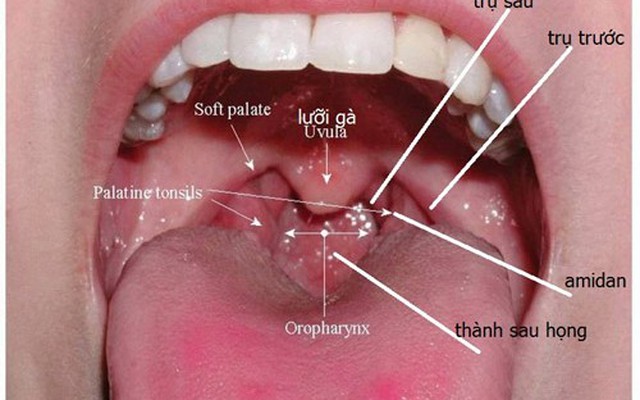 Không muốn chết vì ung thư vòm họng, đừng bỏ qua dấu hiệu sau