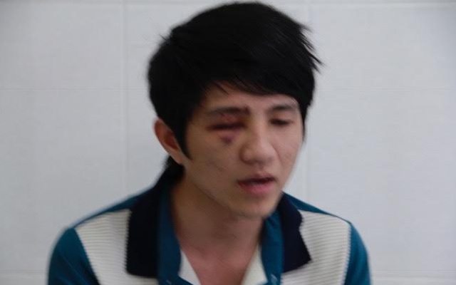 Thanh tra công an tỉnh xác minh nghi vấn "CSGT quơ gậy khiến thanh niên chấn thương mắt"