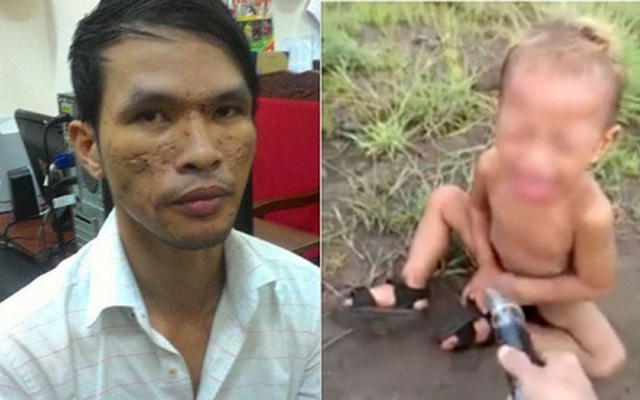 Vụ chích điện bé trai là trường hợp đầu tiên ghi nhận tại Campuchia