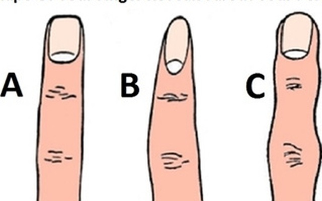 Hình dáng ngón tay tiết lộ tính cách bạn