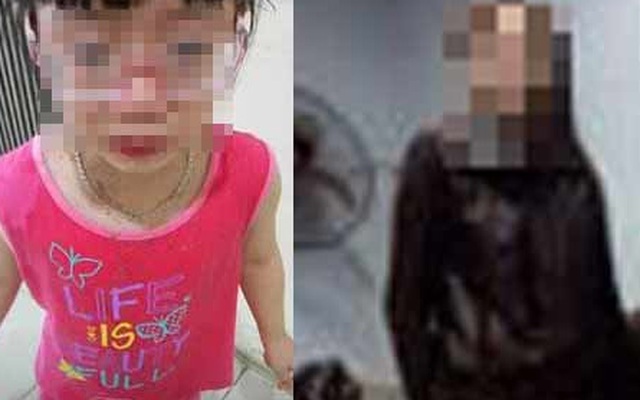 Hà Nội: Cô giáo Mỹ hất mắm tôm vào người bé gái 5 tuổi