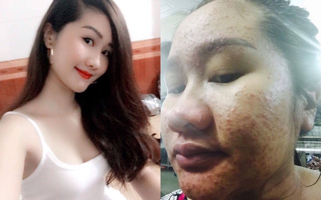 Tâm sự bi thương của người mẹ xinh đẹp bỗng "xập xệ" sau khi mang bầu