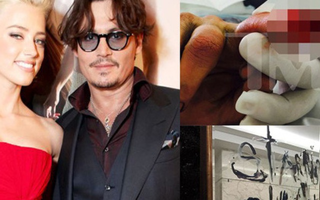 Johnny Depp cắt đứt đầu ngón tay, viết lên gương tố Amber Heard phản bội