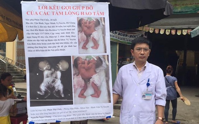 Bác sĩ ra chợ xin từ thiện cứu 2 bé song sinh dính liền: Bị trách nhưng vẫn vui