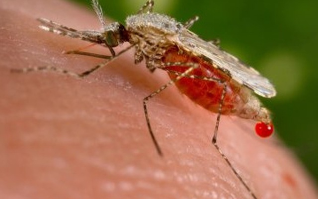 Brazil phát hiện Viruz Zika gây rối loạn não ở người lớn