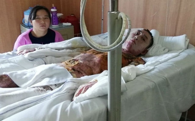 Công ty Trung Quốc gợi ý công nhân chết êm ái vì sợ tốn viện phí
