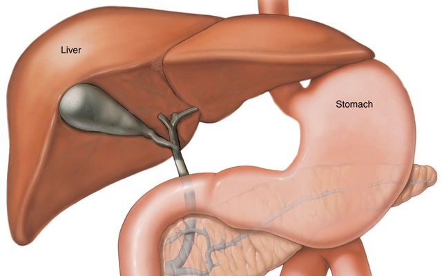 Ung thư gan giai đoạn cuối vì nhầm tưởng đau dạ dày
