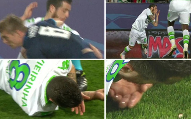 CLIP: Sao Real Madrid vung cùi chỏ gãy răng đối thủ