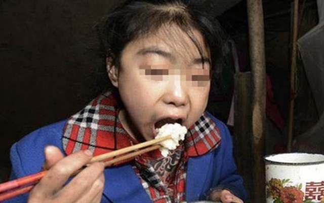 Kỳ lạ bé gái 15 tuổi mỗi ngày ăn 7kg gạo nhưng không mập lên nổi