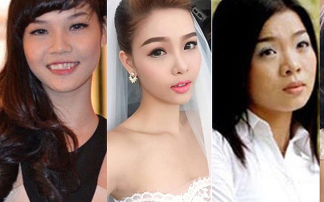 7 sao Việt "lên đời" nhan sắc sau khi dao kéo mũi