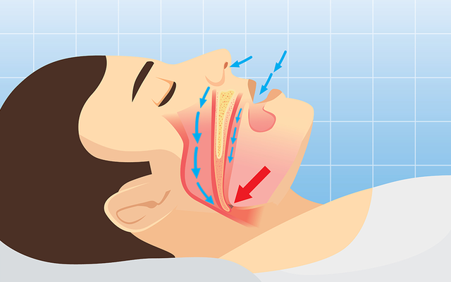 6 căn bệnh nguy hiểm 'âm thầm tấn công' nên lúc phát hiện thì... quá muộn!