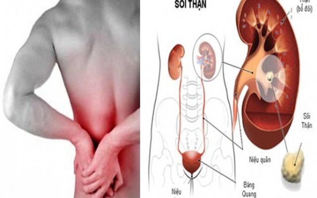 Những dấu hiệu phát hiện sớm bệnh thận