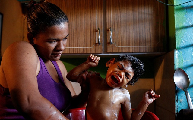 Trẻ em động kinh ở Venezuela trong cơn vật vã vì thiếu thuốc điều trị