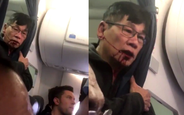 Bác sĩ gốc Việt David Dao sẽ nhận được bao nhiêu tiền bồi thường từ hãng United Airlines?