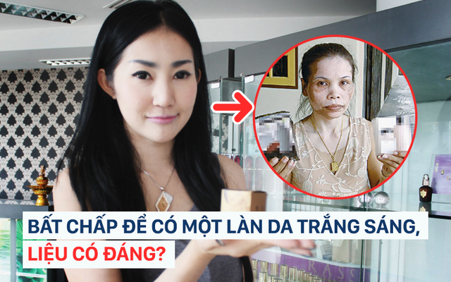 Bất chấp để có được làn da trắng sáng, nhiều phụ nữ đã dại dột biến mình thành "thảm họa"