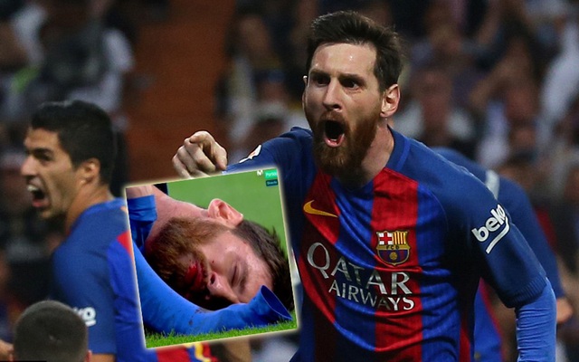 Messi: Nỗi bất công cùng cực, cú đánh hộc máu mồm và 2 "cái tát" vào mặt Real Madrid