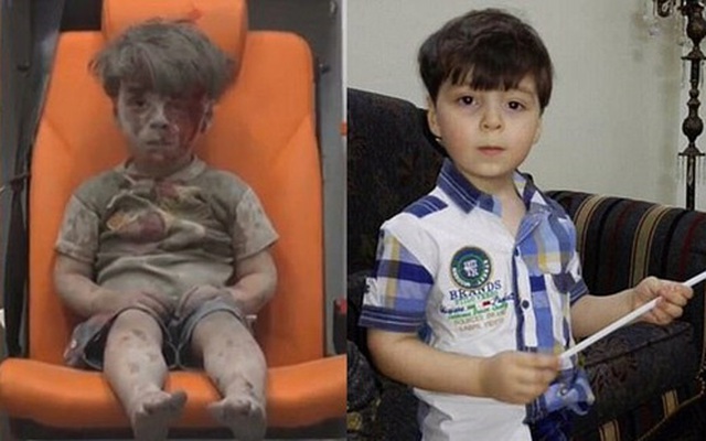 Cậu bé Syria khuôn mặt bê bết máu một năm trước giờ ra sao?
