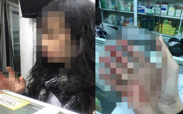 Uber lên tiếng việc nữ hành khách ở Hà Nội bị tài xế đánh "bầm mặt, chảy máu"