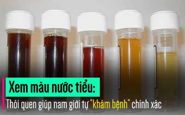 Xem màu nước tiểu: Cách tự “khám” ra bệnh quý ông nào cũng nên biết sớm