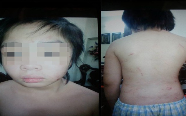 Hà Nội: Tạm giữ hình sự người cha liên quan đến việc bé trai bị rạn xương sọ