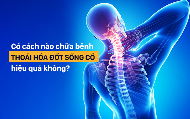 Giải pháp chữa bệnh thoái hóa đốt sống cổ: Kể cả khi chưa mắc bệnh cũng nên tham khảo sớm