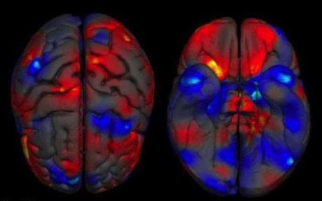 Bạn có tin: Bộ não của nam giới thực sự lớn hơn nữ giới?