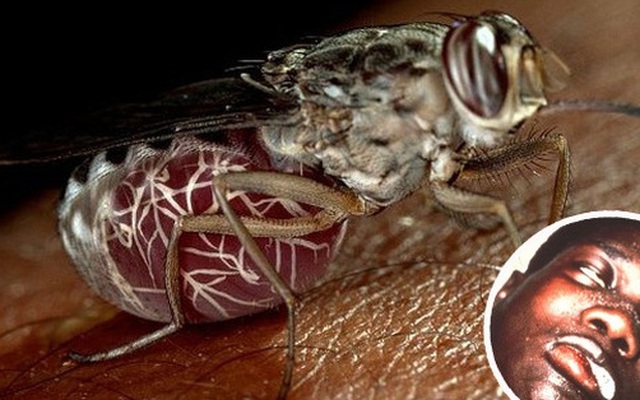 Phát hiện ra cơ chế hút, truyền bệnh chết người - nguy hiểm hơn cả sốt xuất huyết của loài ruồi xê xê