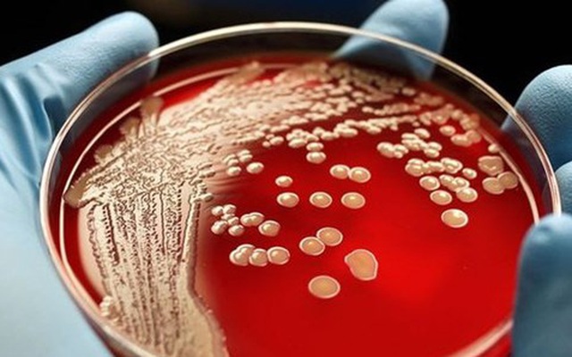 Siêu vi khuẩn kháng thuốc xuất hiện nhiều ở bệnh viện là loại nào?
