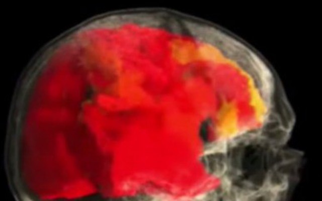 Video thú vị scan bộ não người phụ nữ trong suốt quá trình đạt cực khoái