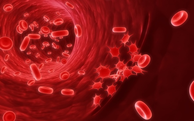Tiến sĩ Mỹ hướng dẫn 5 bước làm sạch hệ bạch huyết, ngừa mọi bệnh tật