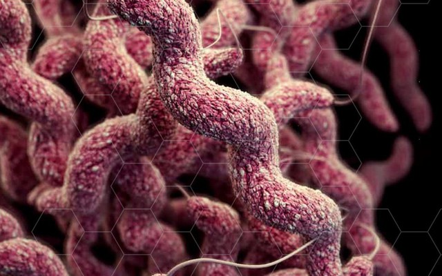 Siêu khuẩn kháng thuốc có thể giết 10 triệu người/năm