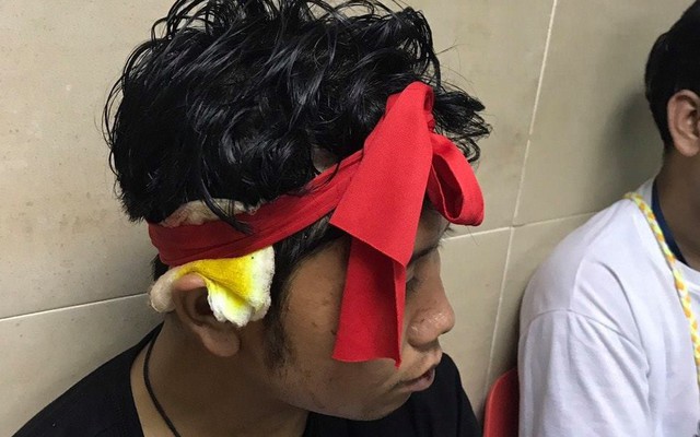 CĐV Myanmar bị đánh chảy máu đầu khi sang Malaysia cổ vũ đội nhà