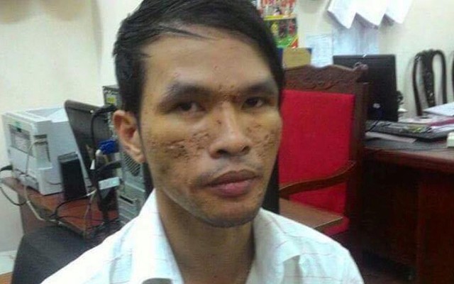 Kẻ hành hạ dã man em bé Campuchia được tại ngoại do mắc bệnh nan y
