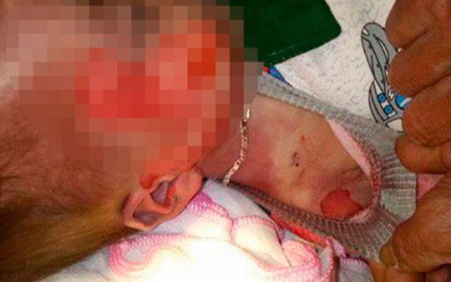 Vụ bé 15 tháng tuổi tử vong với nhiều vết thương "lạ": BV khẳng định không làm rơi bệnh nhi