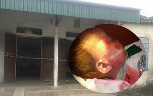 Bộ Y tế yêu cầu báo cáo  vụ cháu bé tử vong với vết thương "lạ" sau khi đi cấp cứu