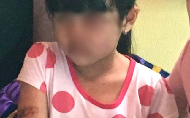 Bé gái nghi bị bạo hành ở Kiên Giang: Xin ý kiến từ Bộ Công an