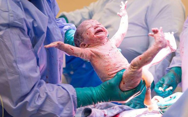 Bức ảnh em bé sơ sinh căng mình chào thế giới khiến dân mạng thích thú